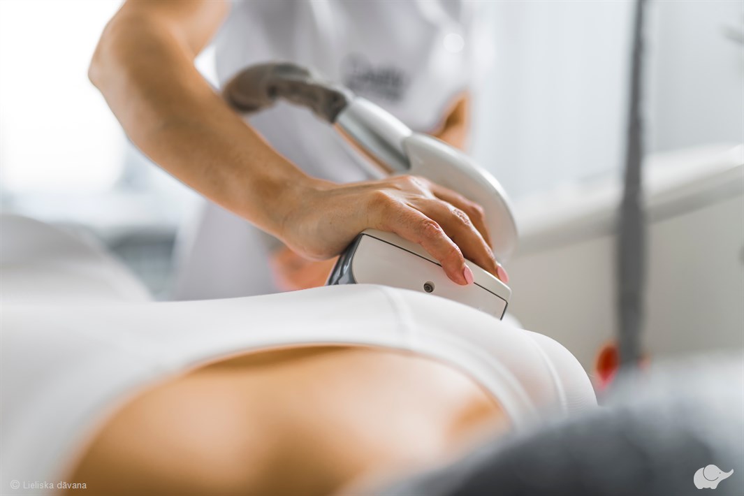 LPG ķermeņa lipomasāža salonā „MON AMI“