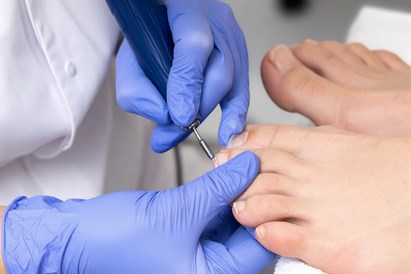 Pilna pēdu aprūpe pie podologa “RE.NEW” estētiskās medicīnas klīnikā