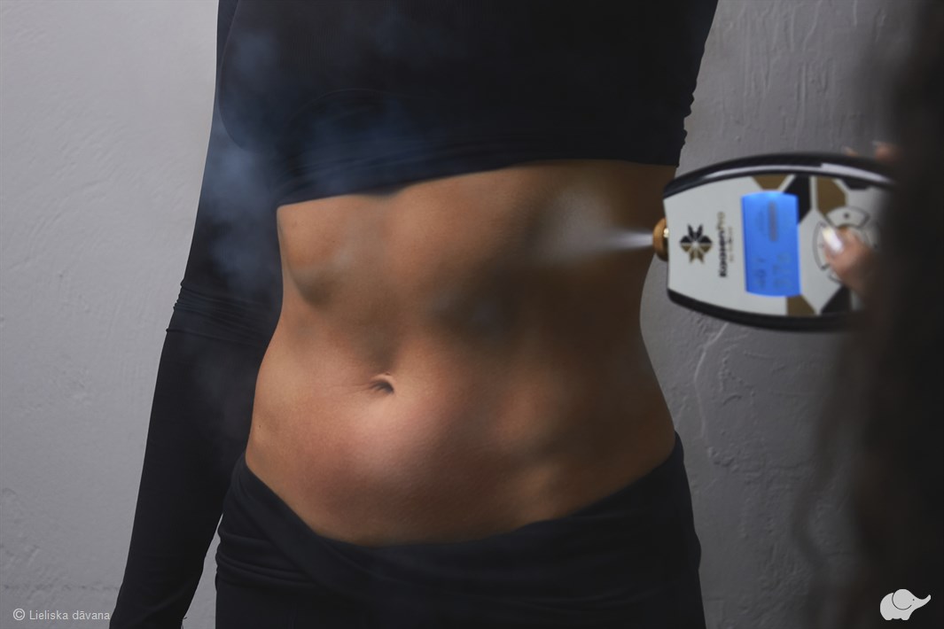 “TruCryo Kaasen” lokālā aukstuma terapija efektīvai tauku dedzināšanai