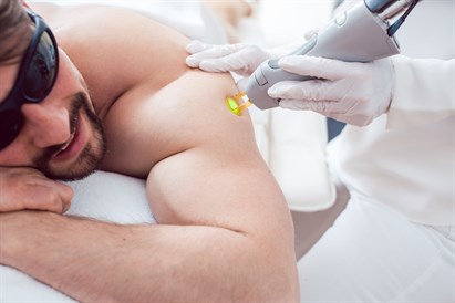 Lāzerepilācijas procedūras vīriešiem klīnikā “ERA ESTHETIC”